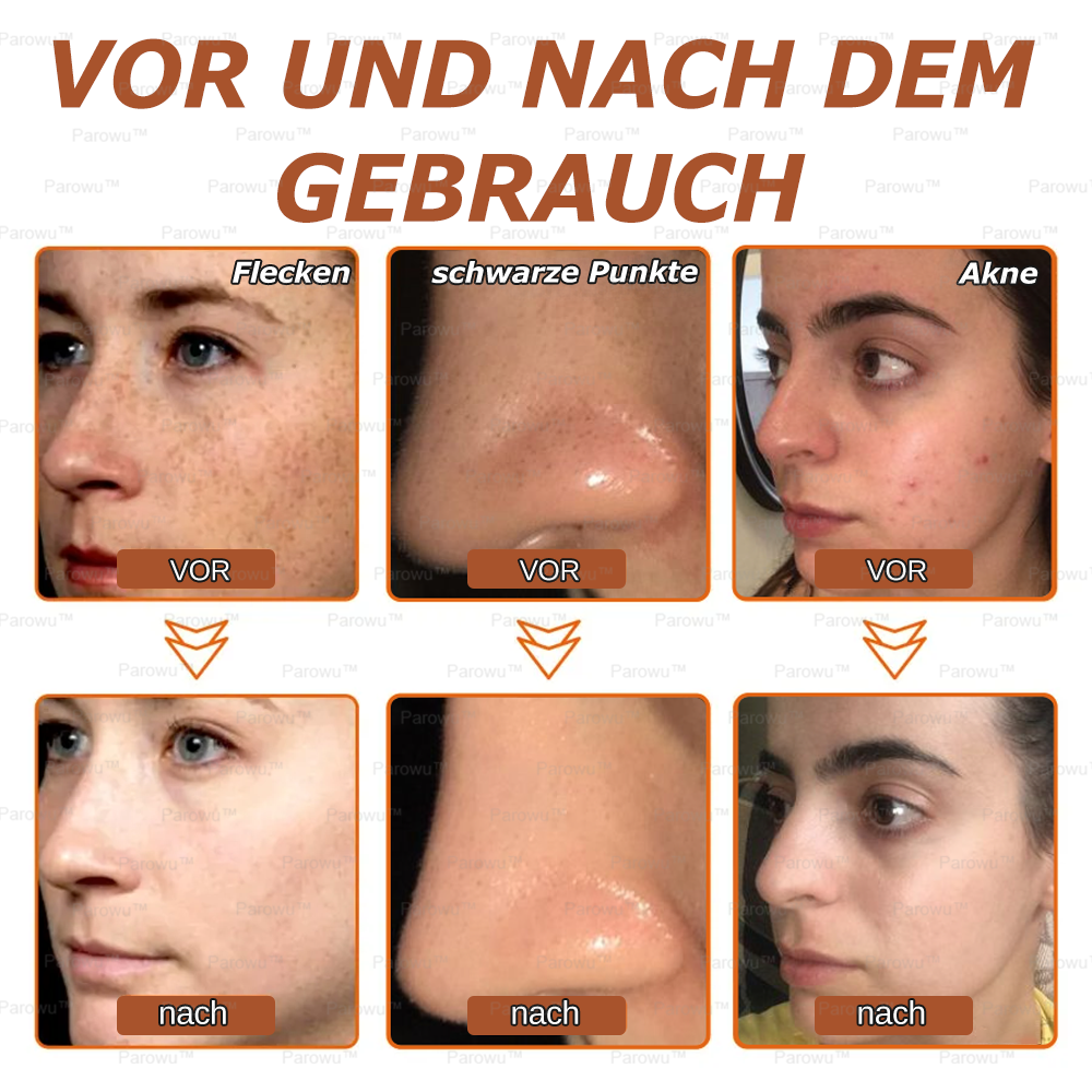 🌼 Nur 5 übrig! Parowu™ Aufhellende & Fleckenentfernende Gesichtsmaske -50%! Schluss mit Melanin – Jetzt kaufen, sonst bis 2026 warten! 🌼