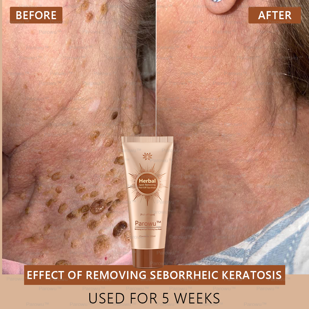 🌼 Nur 5 übrig! Parowu™ Aufhellende & Fleckenentfernende Gesichtsmaske -50%! Schluss mit Melanin – Jetzt kaufen, sonst bis 2026 warten! 🌼