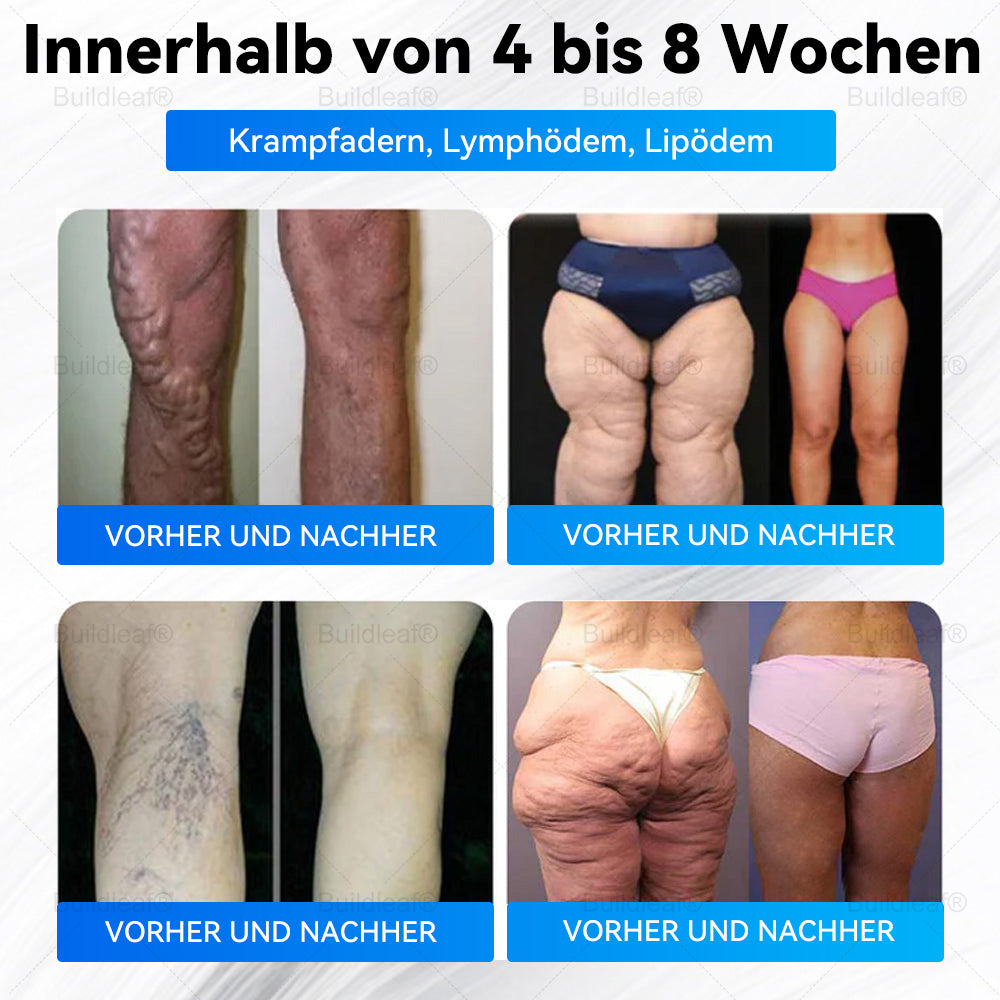 đHerzlichen GlĂŒckwunsch! Du hast ein exklusives Buildleaf-Angebot freigeschaltet!đ Als Dank fĂŒr deine Bestellung erhĂ€ltst du heute zusĂ€tzlich 50âŻ% Rabatt! Denk dran, dieses Angebot gilt nur heute â nutze es jetzt und sichere dir deinen Vorteil!