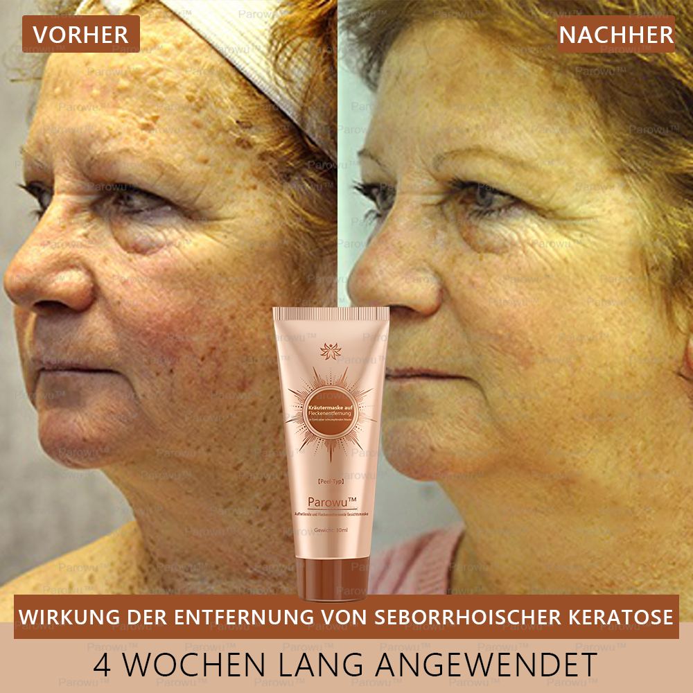 🌼 Nur 5 übrig! Parowu™ Aufhellende & Fleckenentfernende Gesichtsmaske -50%! Schluss mit Melanin – Jetzt kaufen, sonst bis 2026 warten! 🌼