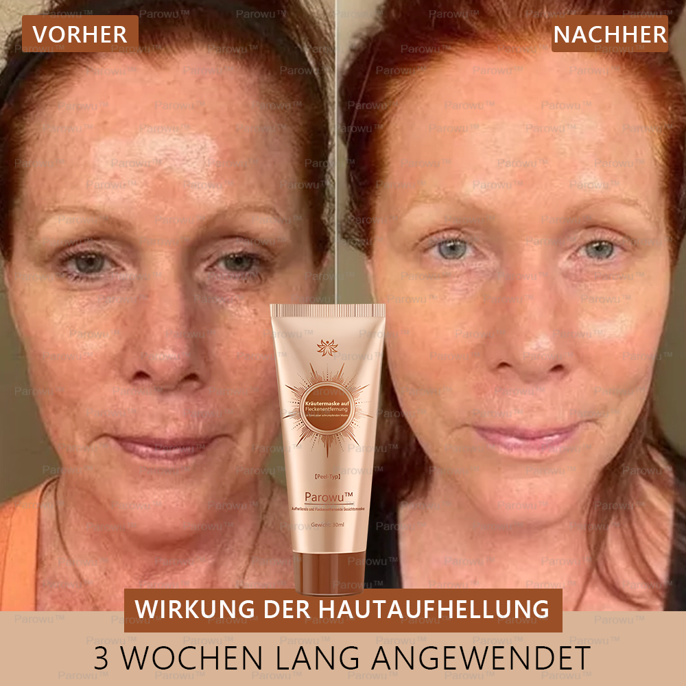💟 Parowu™ Aufhellende und Fleckenentfernende Gesichtsmaske - Geeignet für Gesicht und Körper – 👩⚕️ Natürliche Inhaltsstoffe entfernen dauerhaft Altersflecken, Sommersprossen, Sonnenflecken und Leberflecken.