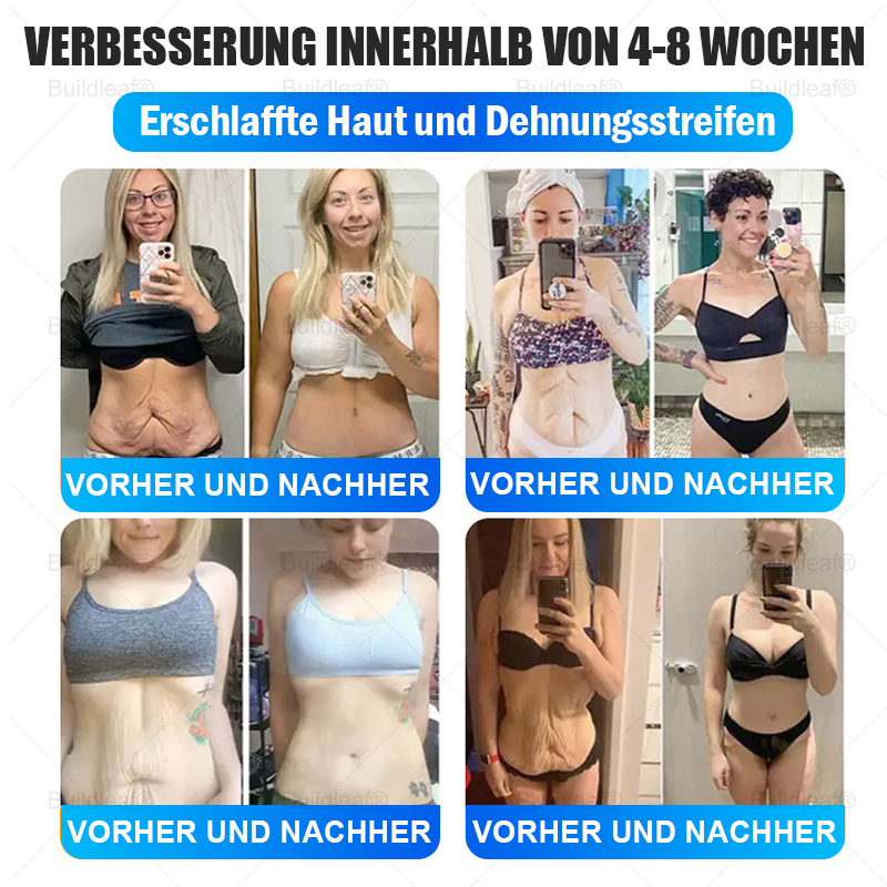 🎉Herzlichen Glückwunsch! Du hast ein exklusives Buildleaf-Angebot freigeschaltet!🎁 Als Dank für deine Bestellung erhältst du heute zusätzlich 50 % Rabatt! Denk dran, dieses Angebot gilt nur heute – nutze es jetzt und sichere dir deinen Vorteil!