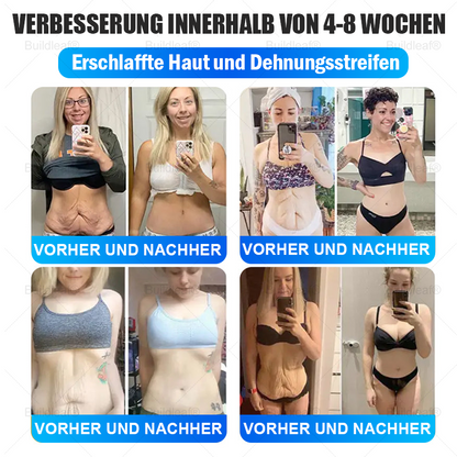 🎉Herzlichen Glückwunsch! Du hast ein exklusives Buildleaf-Angebot freigeschaltet!🎁 Als Dank für deine Bestellung erhältst du heute zusätzlich 50 % Rabatt! Denk dran, dieses Angebot gilt nur heute – nutze es jetzt und sichere dir deinen Vorteil!