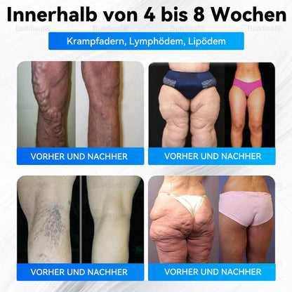 🎉Herzlichen Glückwunsch! Du hast ein exklusives Buildleaf-Angebot freigeschaltet!🎁 Als Dank für deine Bestellung erhältst du heute zusätzlich 50 % Rabatt! Denk dran, dieses Angebot gilt nur heute – nutze es jetzt und sichere dir deinen Vorteil!