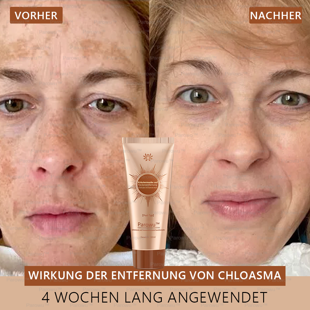 🌼 Nur 5 übrig! Parowu™ Aufhellende & Fleckenentfernende Gesichtsmaske -50%! Schluss mit Melanin – Jetzt kaufen, sonst bis 2026 warten! 🌼